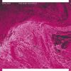 Download track Slow Loris Versus Poison Snail