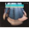 Download track 02. Suite En Re Majeur - Rigaudon