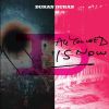 Download track All You Need Is Now