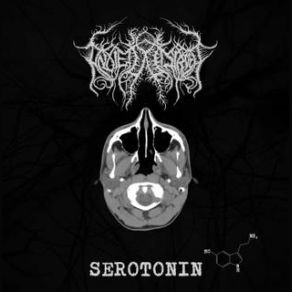 Download track Grief Serotonin, Anxiety Disorder