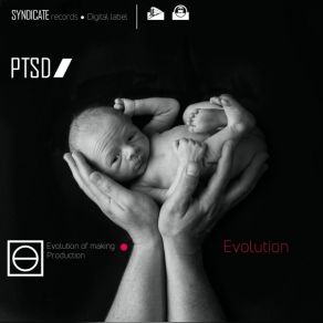 Download track Static Program Ptsd