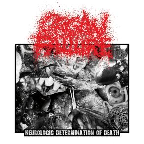 Download track Transferred To The Morgue Organ Failure