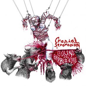 Download track Intro Cranial Separation